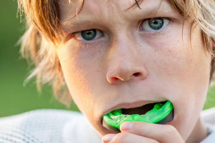 custom made mouthguard